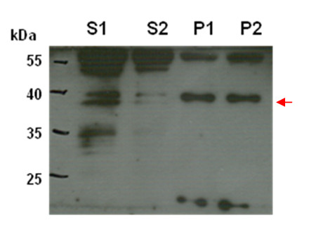 western blot detection using CTP6 antibodies